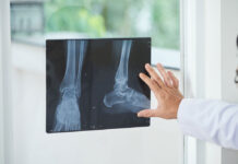 Рентген конечностей: когда нужен, что показывает и как подготовиться