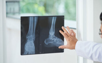 Рентген конечностей: когда нужен, что показывает и как подготовиться